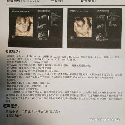 做四维是几个月做