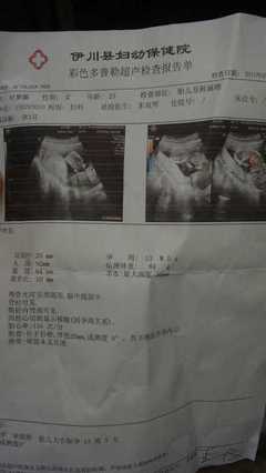 怀孕三个月怎么看男女
