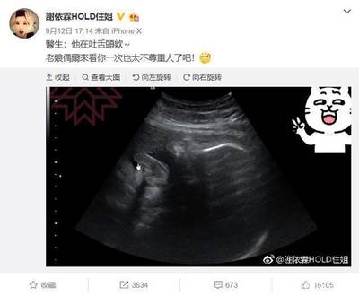 一般怀孕几个月会吐