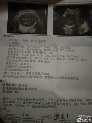 胎儿绕颈一周可以顺产吗