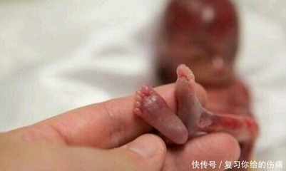 胎儿四个月有多大