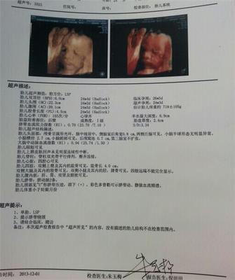 八个月胎儿发育情况对照表