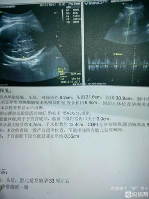 怀孕36周孩子一般几斤