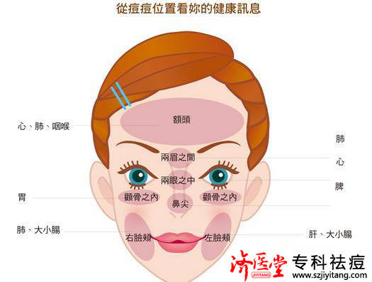 眉上张痘痘是怎么回事