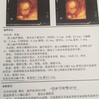 怀孕25周胎儿有多大