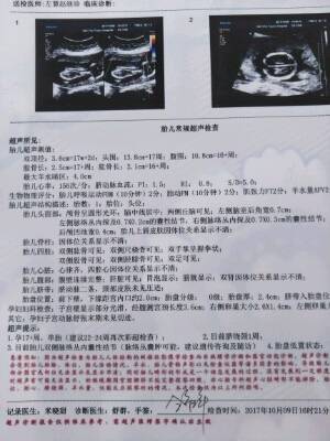 十七周胎儿