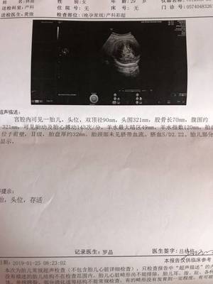 胎儿头位是入盆了吗