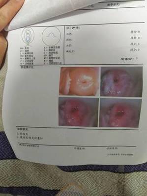 宫颈囊肿可以怀孕吗