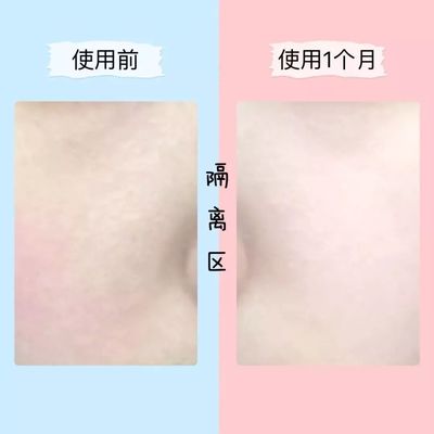 一个痘痘的生长周期