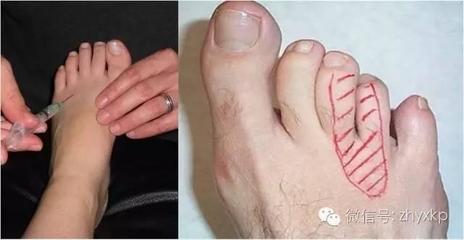 脚趾头疼痛是怎么回事