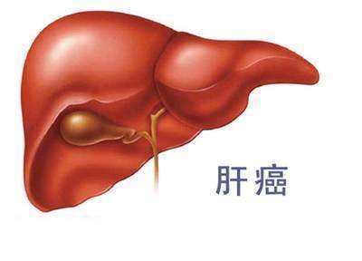 肝上有肿瘤该怎么治疗生存多久
