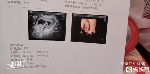 怀孕13周是孕中期吗