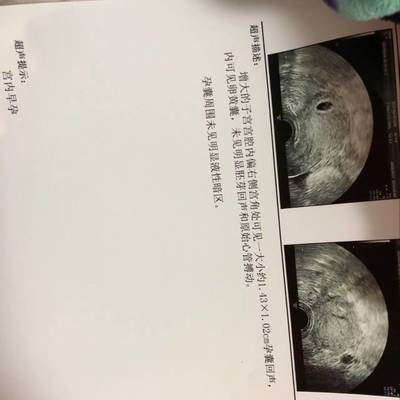 怀孕21天能看到孕囊吗