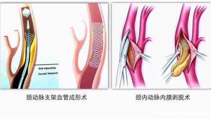内膜增厚怎么治疗好