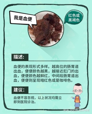 新生儿大便出血