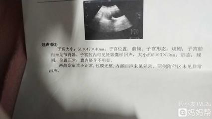 多少天会怀孕