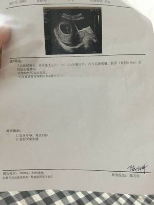 全麻之后多久可以怀孕