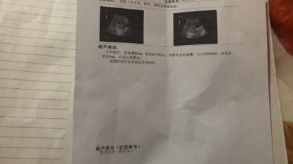 怀孕10周图片