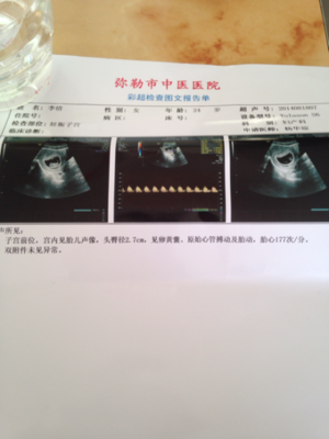 胎儿心跳太快怎么回事