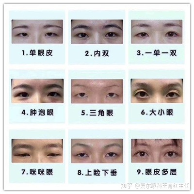 眼皮为什么一单一双