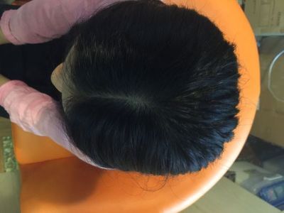 做梦头发掉光