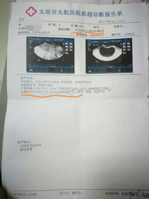 卵巢囊肿社保报销多少