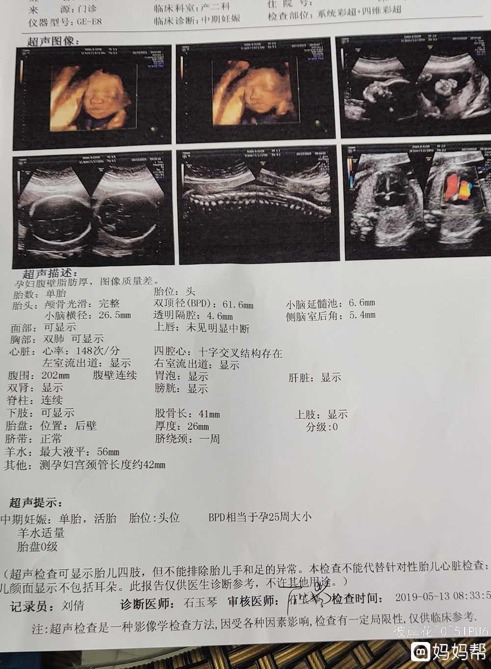 胎儿单独做心脏彩超多少钱