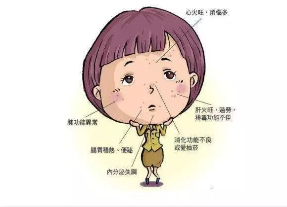 青春期额头长痘痘是什么原因