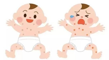 两个月宝宝过敏图片