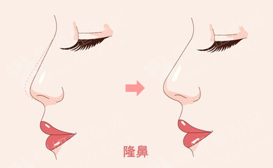 牡丹江美神双眼皮