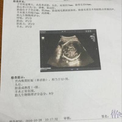 胎儿头位是入盆了吗
