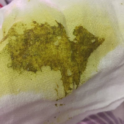 便便有泡泡是怎么回事