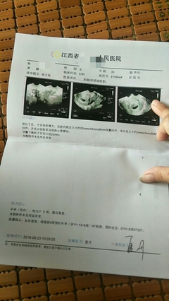 月经完第一天会怀孕吗