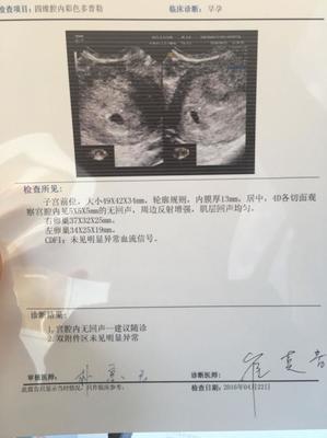 流产多久能怀孕