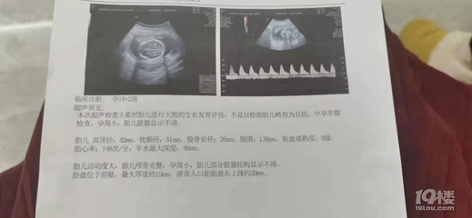 十八周胎儿发育图片