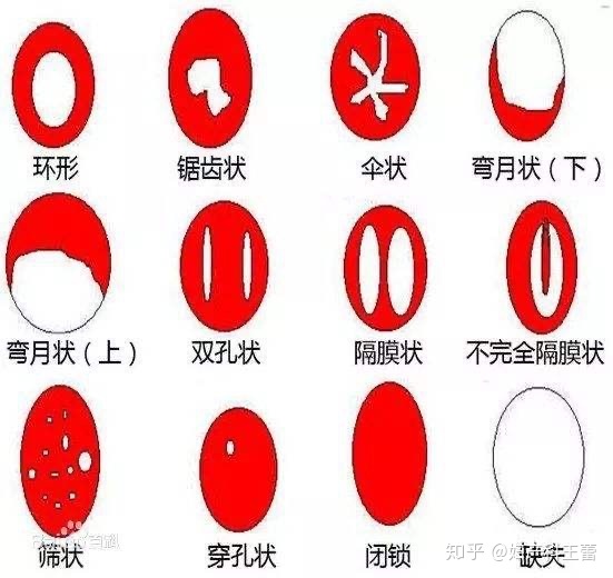 男生第一次出血是怎么回事