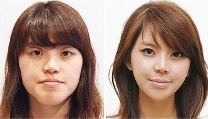 整容脸部