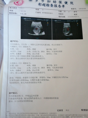 胎儿心脏彩超检查什么内容