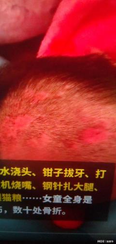 全身烫是怎么回事