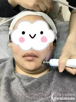 纹眉10天了可以敷面膜