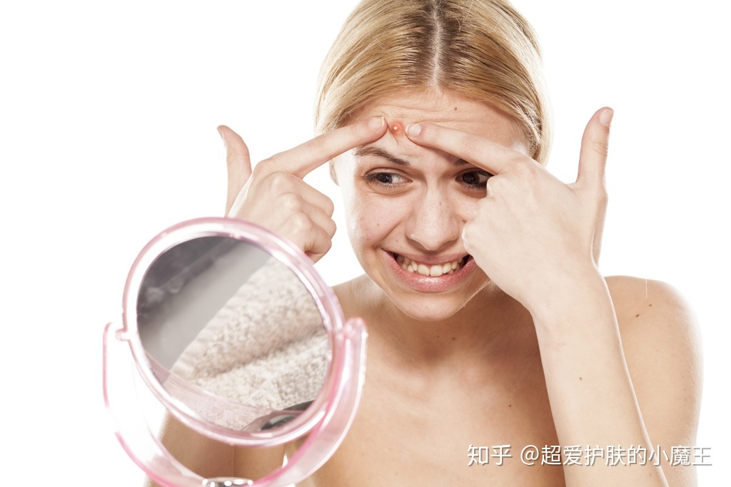 怎样祛痘痘印小妙招