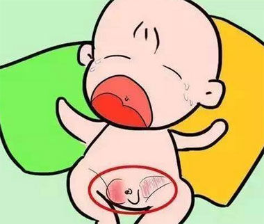 男宝宝蛋蛋疝气症状