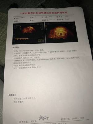 女人梦见自己来月经了什么预兆