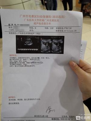 三个月流产疼吗