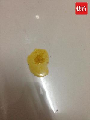 小便发浑是怎么回事