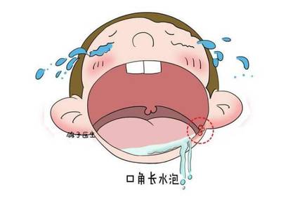 宝宝上火口腔溃疡怎么办
