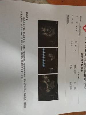 十七周胎儿