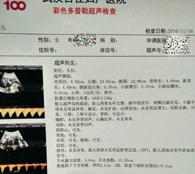 小排畸有宝宝照片吗