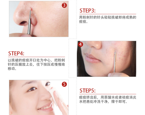 挑痘痘后能洗脸吗
