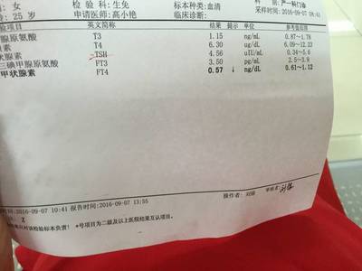 新生儿甲减症状
